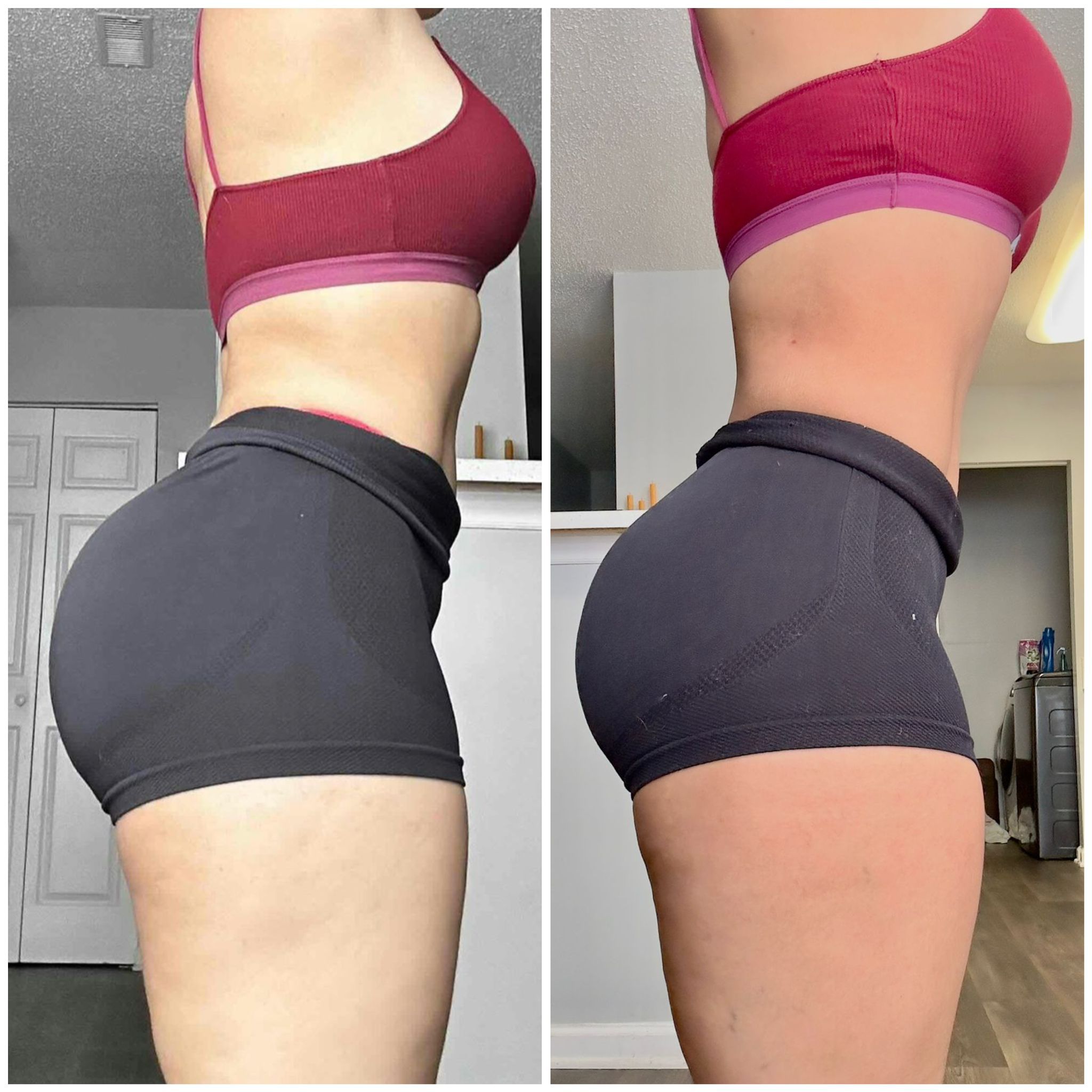 Before After photo 3