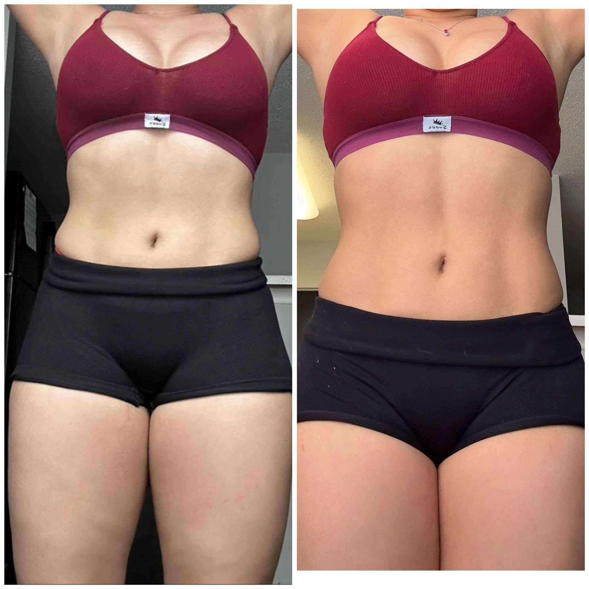 Before After photo 5