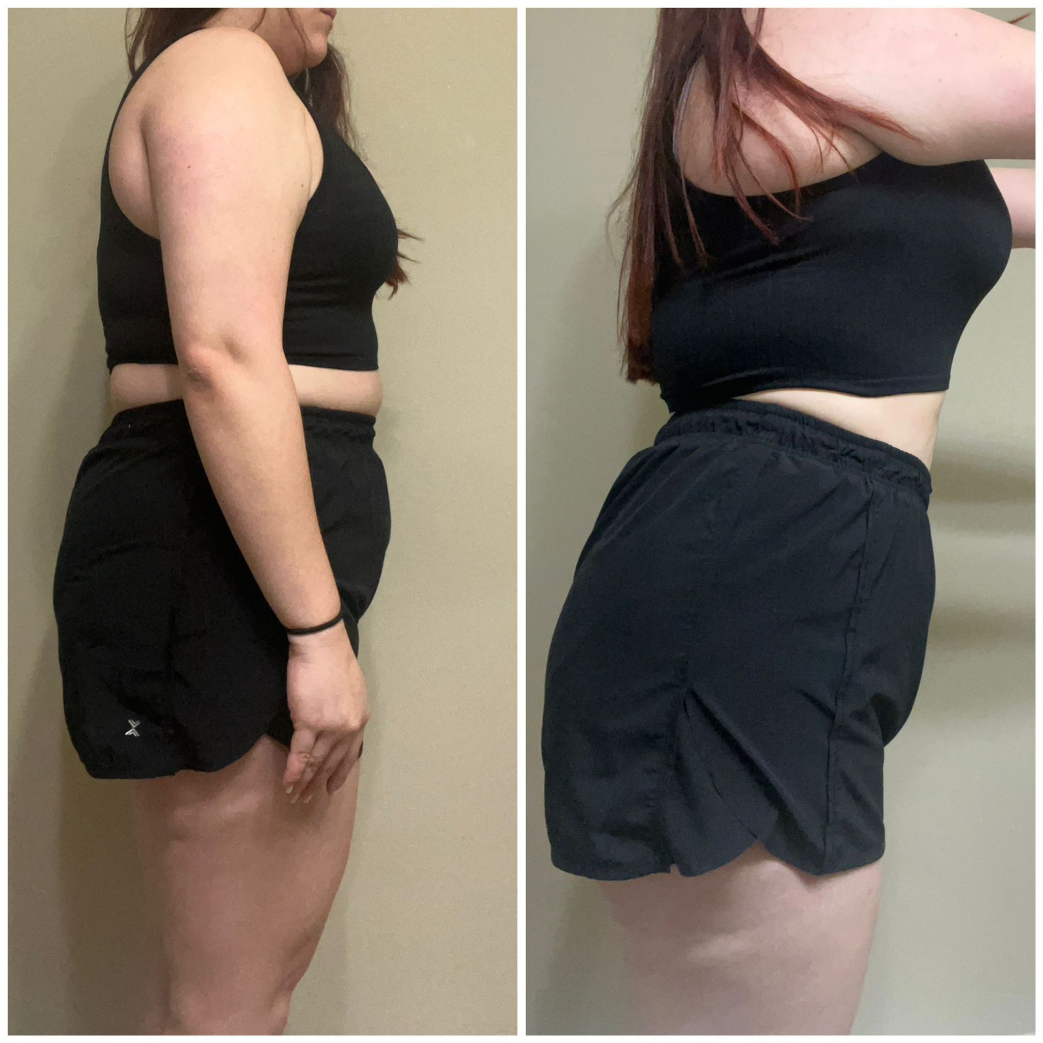 Before After photo 2