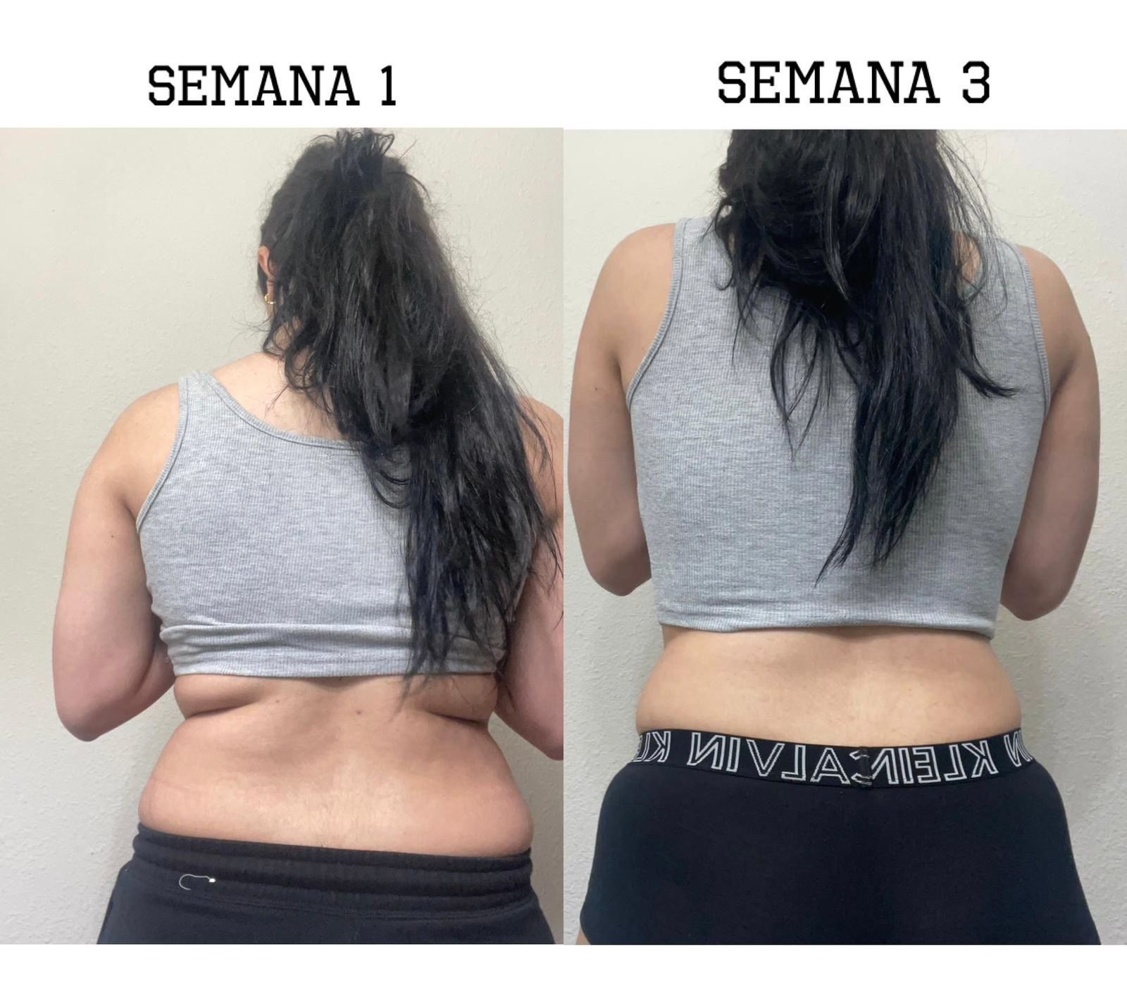 Before After photo 10