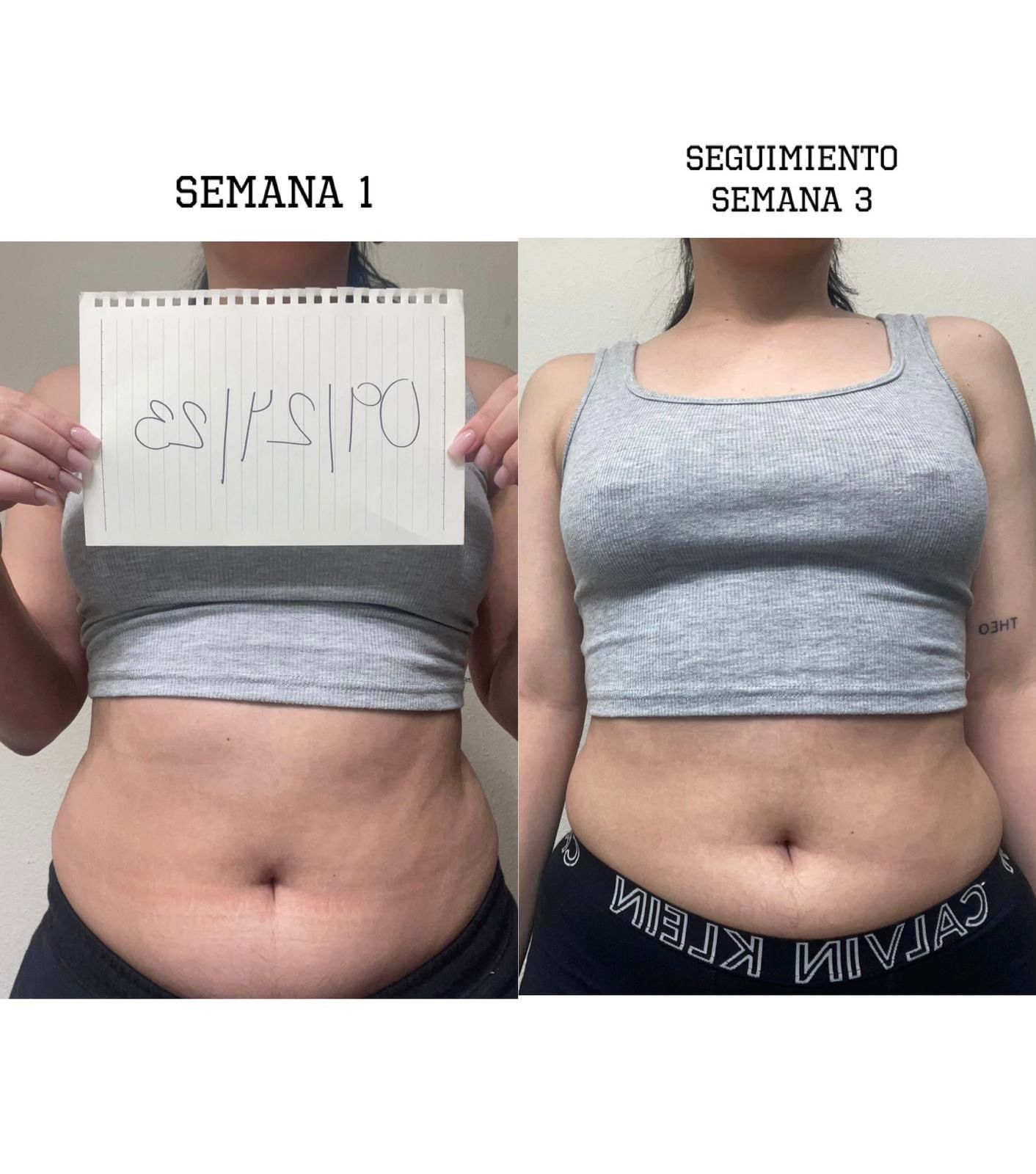 Before After photo 11