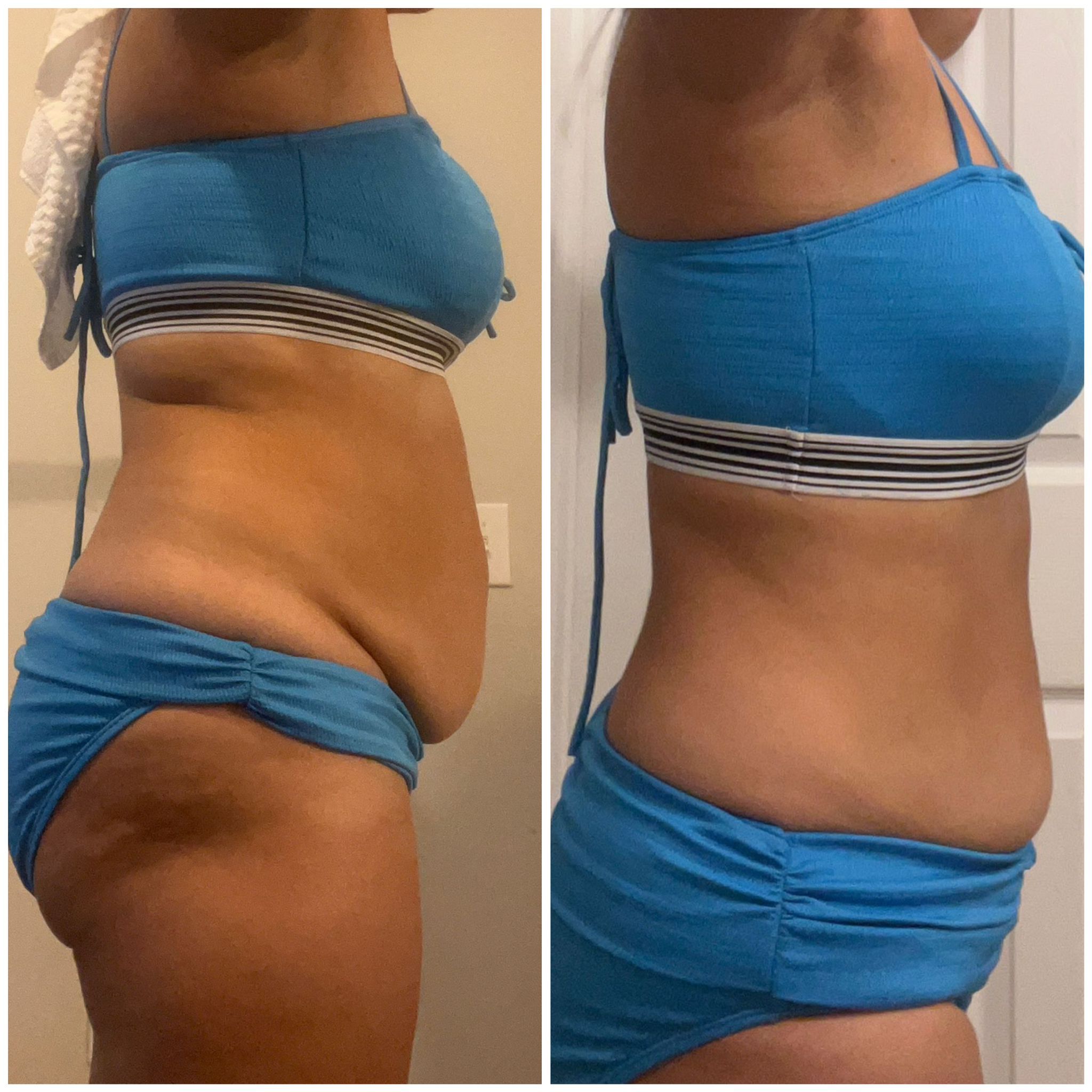 Before After photo 7