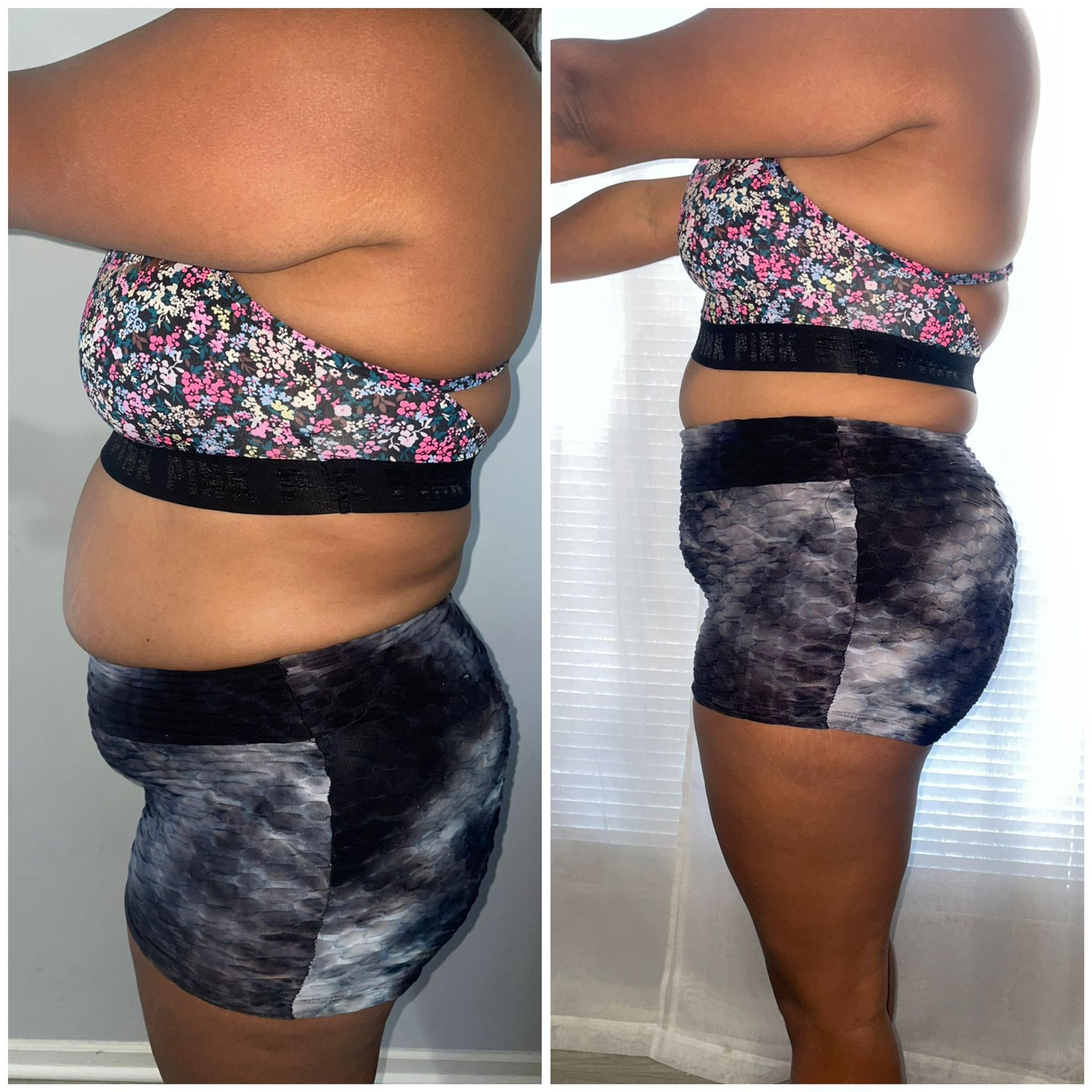 Before After photo 9